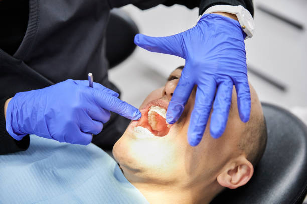 Best Urgent Tooth Repair  in Minco, OK
