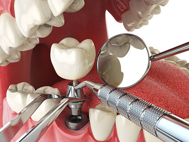 Best Cracked Tooth Emergency Dentist  in Minco, OK